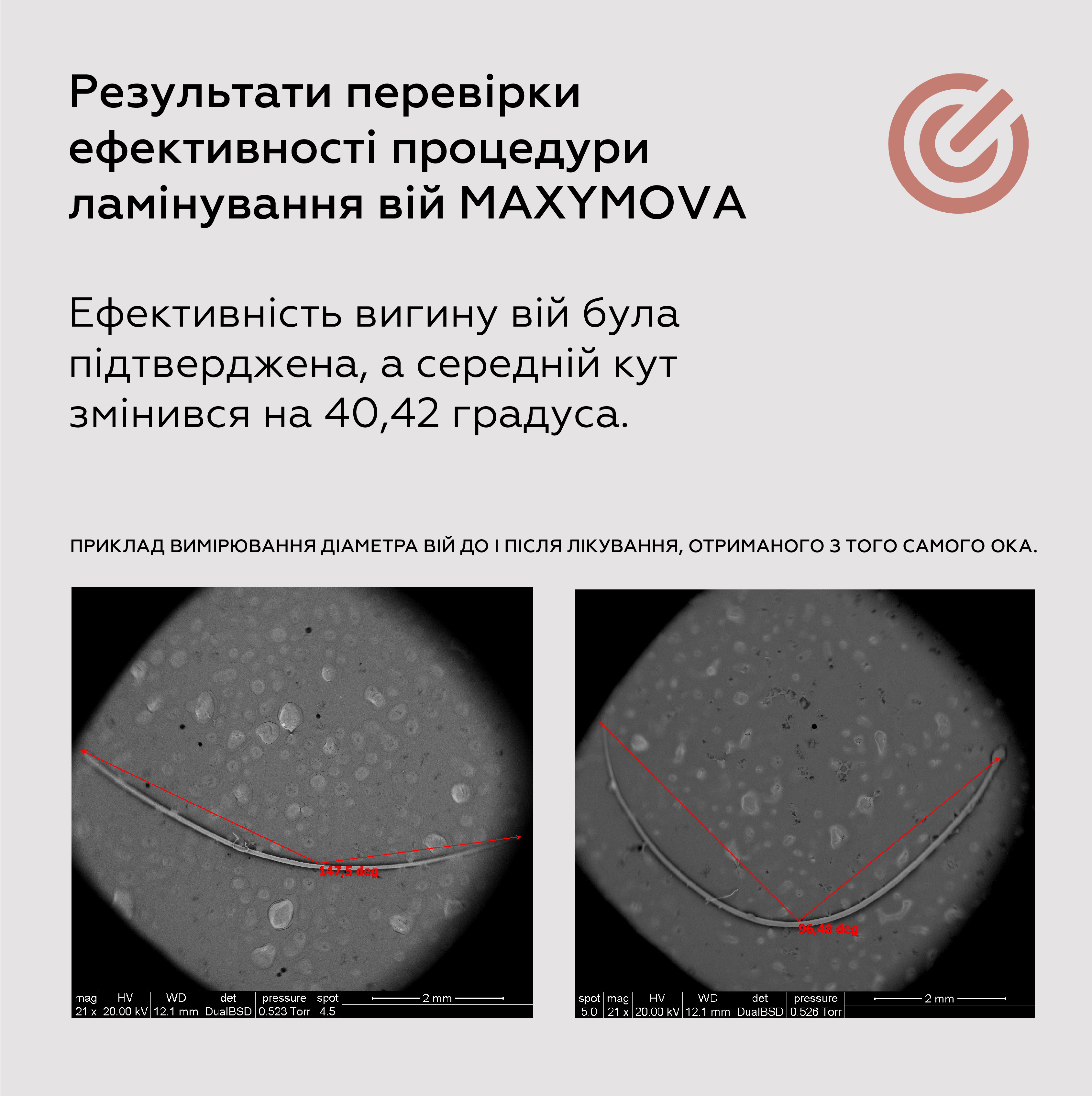Maxymova Discovery kit (step 1, 2, 3 + золото в саше)