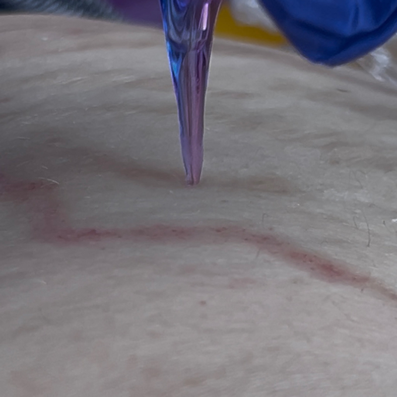 SKINSCULPT MICRONEEDLING THERAPY Suero para microneedling Stretch Marks Formula 30 ml